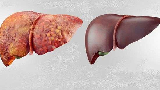 Как очистить печень в короткие сроки, 6 натуральных продуктов