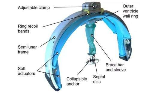 В США создали робота, заставляющего сердце биться