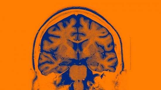 С помощью ИИ и нейроимплантов будут лечить психические расстройства