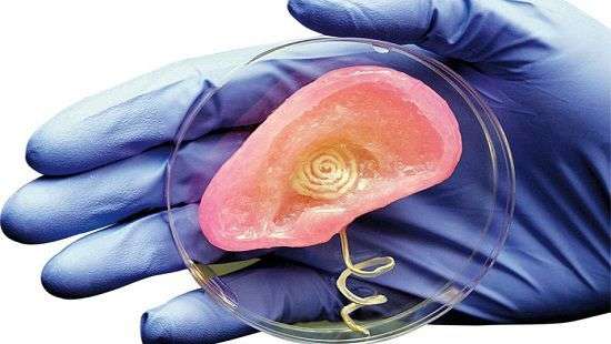 Как 3-D печать изменит мир протезирования, рассказали эксперты