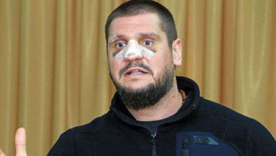 Глава Николаевской ОГА пришел на открытие новогодней елки с разбитым лицом (ВИДЕО)