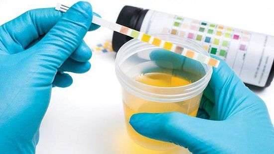 Врачи научились определять рак по анализу мочи