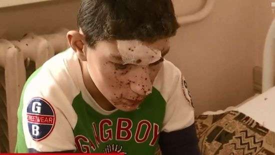 На Днепропетровщине школьники получили травмы при взрыве петарды