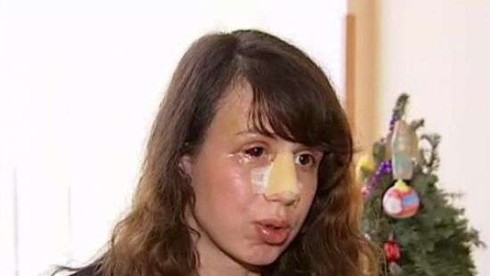 ГПУ направила в суд обвинительный акт в отношении подозреваемого в покушении на Черновол