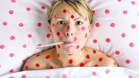 Минздрав дал рекомендации тем, кто контактировал с больными корью