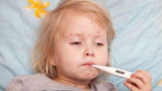 Из-за вспышки кори в Украине Россия усилила контроль на границе