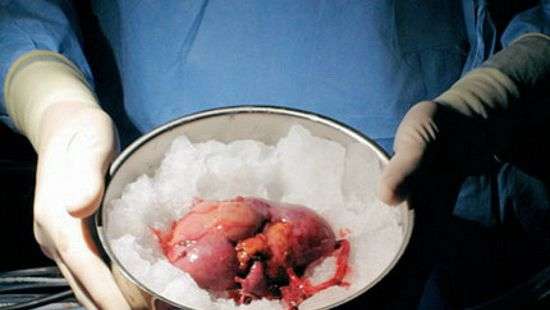 В Каире обнаружили фабрику донорских органов