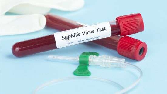 На востоке Словакии объявили эпидемию сифилиса