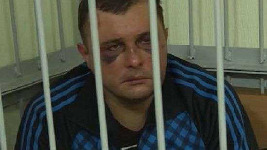 Матиос заявил, что задержанный Шепелев не может говорить из-за сломанной челюсти