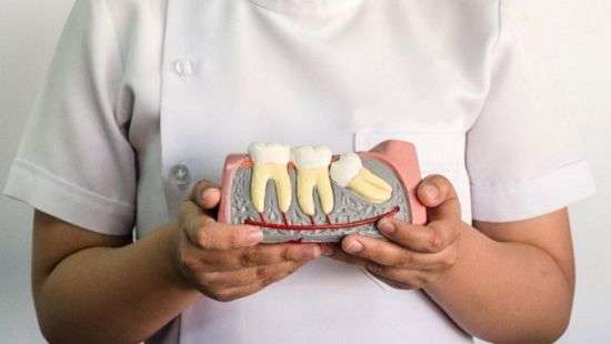 Стоматологи развенчали главные мифы про зубы мудрости