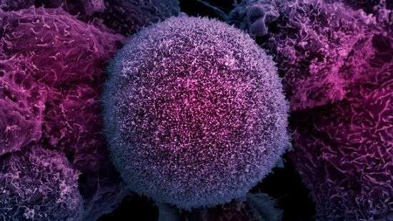 Врачи дали рекомендации, как защититься от рака