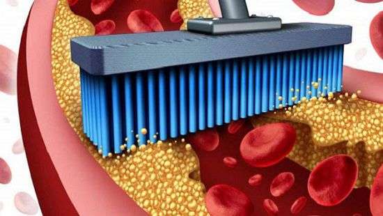 Назван простой способ очистить артерии