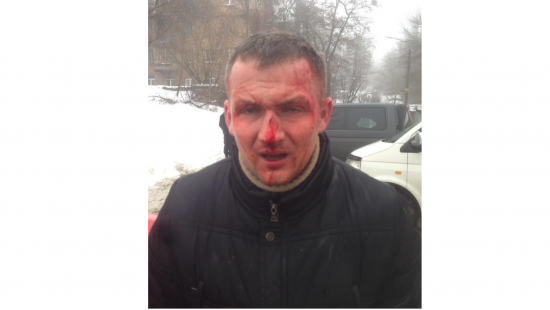 В Киеве до потери сознания избили нардепа от «Свободы» (ФОТО)