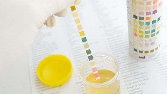 Какие проблемы можно выявить по цвету мочи