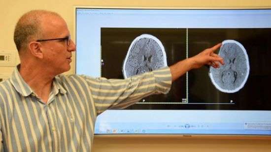 В Израиле парню пересадили череп, напечатанный на 3D-принтере