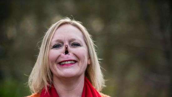 Жительница Британии сняла нос в прямом эфире (ВИДЕО)