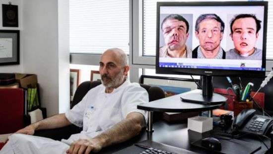 Во Франции мужчине пересадили третье лицо (ВИДЕО)