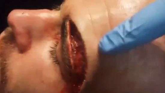 Боец ММА получил самую ужасную травму в истории