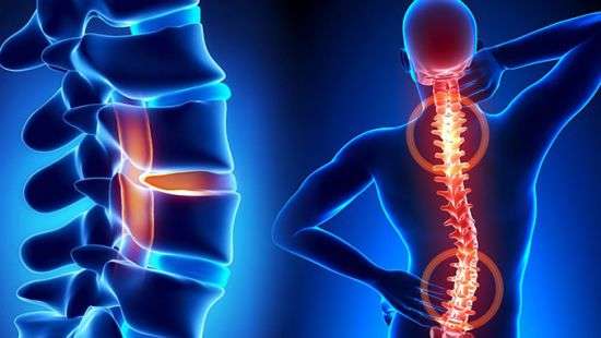 Супрун развеяла очередной миф, на этот раз об остеохондрозе