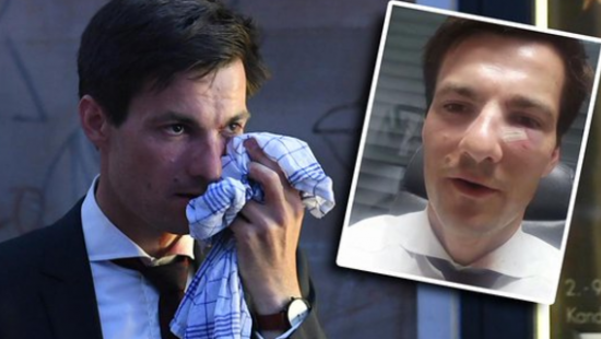 В Германии избили новоизбранного мэра Фрайбурга на его же празднике