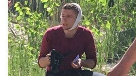 Первая кровь: возле дома Левочкина журналисту разбили голову