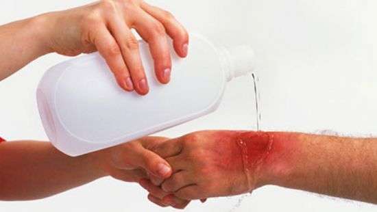 Супрун дала совет, что делать при ожогах