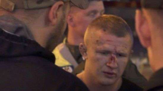 В КГГА отреагировали на избиение болельщиков «Ливерпуля»