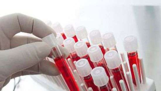 В ЗАГСе молодых проверят на TORCH-инфекции