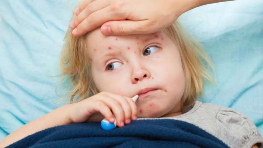 У МОЗ України зробили попередження про спалах хвороби від якої немає ліків У МОЗ України зробили попередження про спалах хвороби від якої немає ліків