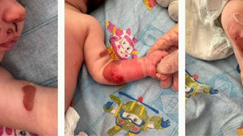 Какие смертельные осложнения могут появиться при заболевании COVID-19 у детей