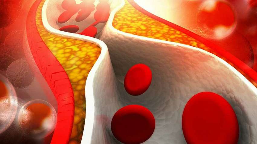 Експерт розповіла, як боротися з холестерином після 50 років
