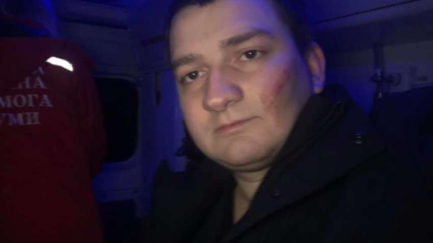 Напад на нардепа в Сумах: депутата «побили» співробітники СБУ