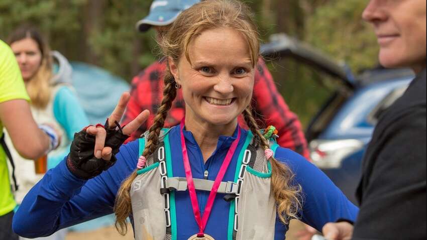 "Відірвали половину голови": чемпіонка Росії постраждала від нападу зграї собак (ФОТО) "Відірвали половину голови": чемпіонка Росії постраждала від нападу зграї собак (ФОТО)