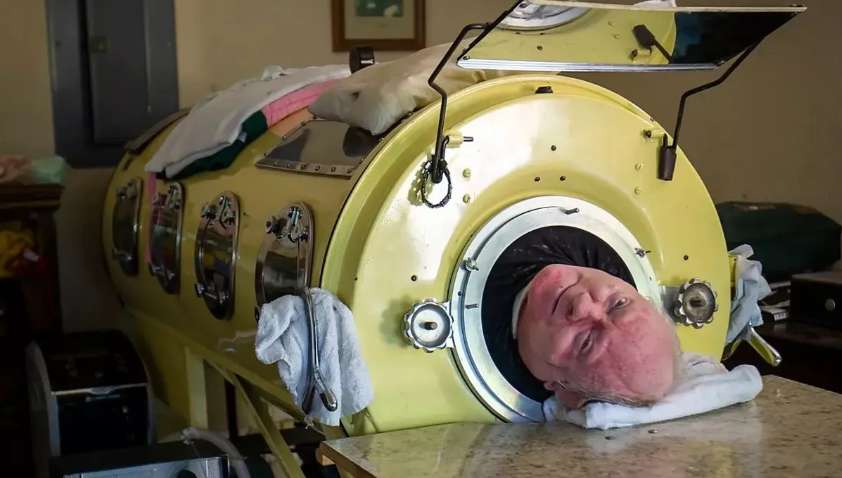 Помер Пол Александер: людина, яка прожила 70 років в залізних легенях