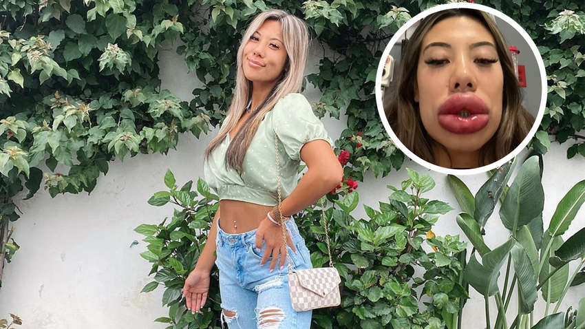 Американка сделала операцию по увеличению губ и получила неожиданный эффект (ФОТО) Американка сделала операцию по увеличению губ и получила неожиданный эффект (ФОТО)