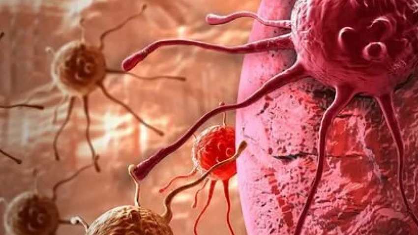 Американські вчені назвали засоби гігієни, які можуть викликати рак Американські вчені назвали засоби гігієни, які можуть викликати рак