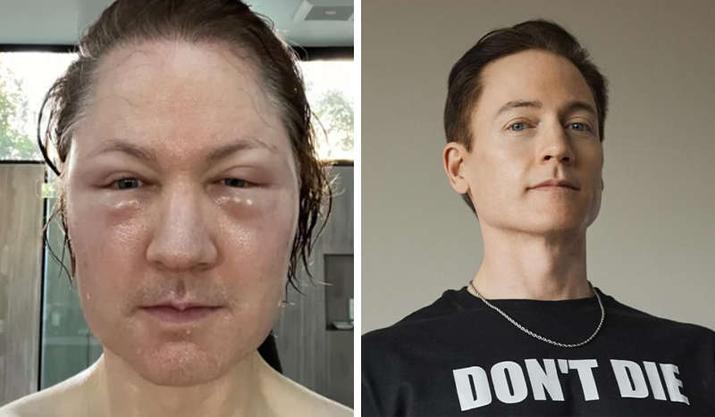 Мільйонер шукає шлях до вічного життя: його новий експеримент зазнав невдачі Мільйонер шукає шлях до вічного життя: його новий експеримент зазнав невдачі