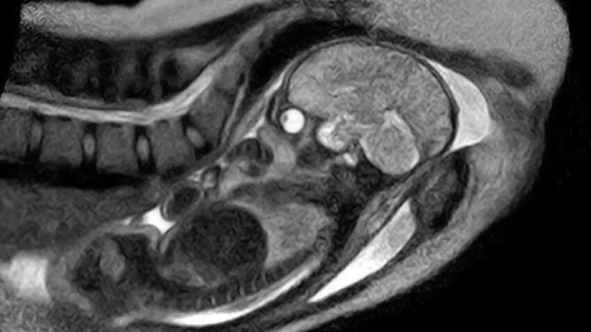 Женщина родила на аппарате МРТ, чтобы показать, что происходит с телом (ВИДЕО) Женщина родила на аппарате МРТ, чтобы показать, что происходит с телом (ВИДЕО)