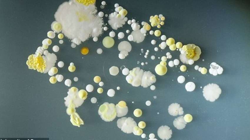 На поверхности смартфонов обнаружили опасные бактерии