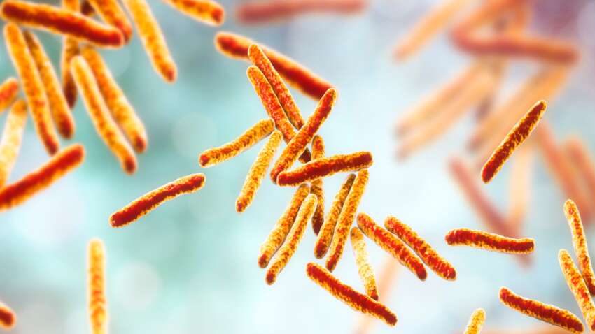 Это вас удивит: из-за чего поднимается заболеваемость туберкулезом в Украине