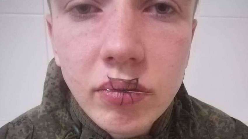 У Росії солдат зашив собі рот (ФОТО) У Росії солдат зашив собі рот (ФОТО)