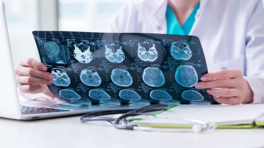 Чи викликає COVID-19 хворобу Паркінсона: що говорить нове дослідження