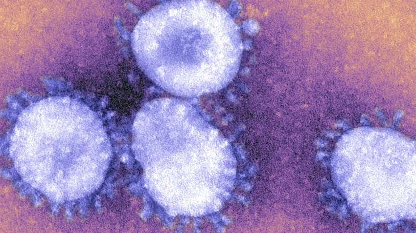 Симптомы атипичной пневмонии Симптомы атипичной пневмонии