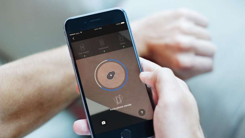Приложение Google Health сможет распознавать кожные заболевания
