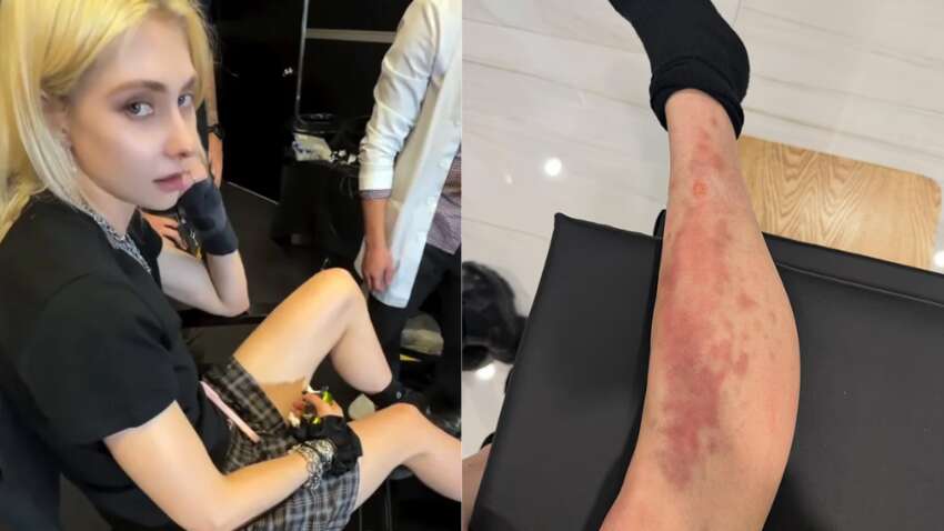 Известную певицу срочно доставили в больницу после укуса ядовитого паука