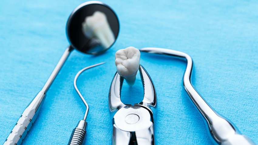 Стоматолог із Німеччини видалив найдовший зуб у світі