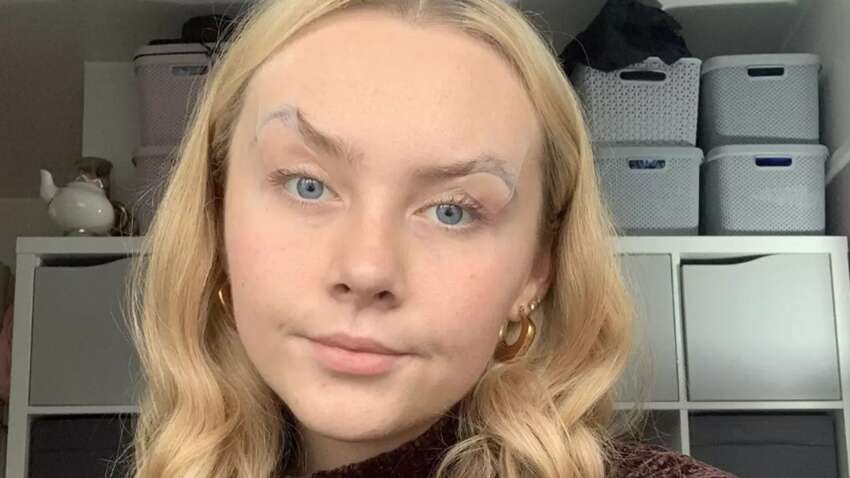 Девушка страдает редким заболеванием: она вынуждена клеить скотч на глаза, чтобы видеть Девушка страдает редким заболеванием: она вынуждена клеить скотч на глаза, чтобы видеть