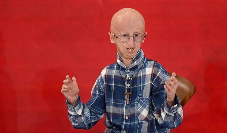 Помер найстаріший у світі пацієнт з прогерією: що це за рідкісна хвороба