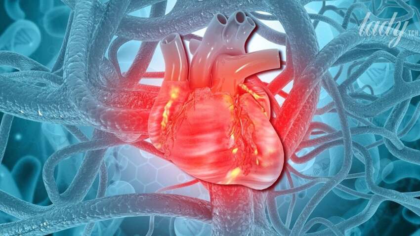 Ці симптоми можуть попередити про майбутній інфаркт: важливе попередження медиків Ці симптоми можуть попередити про майбутній інфаркт: важливе попередження медиків