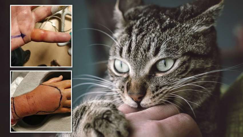 После укуса кота у мужчины из Великобритании обнаружили неизвестную ранее инфекцию